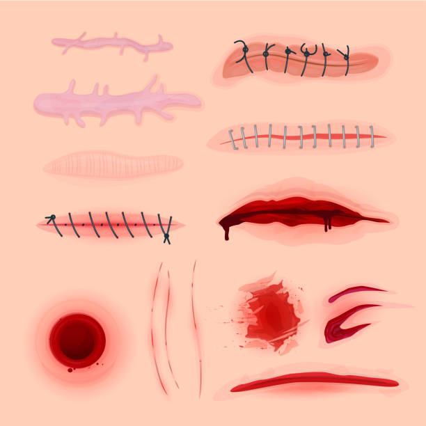 Detail Scar Wound Clipart Nomer 3