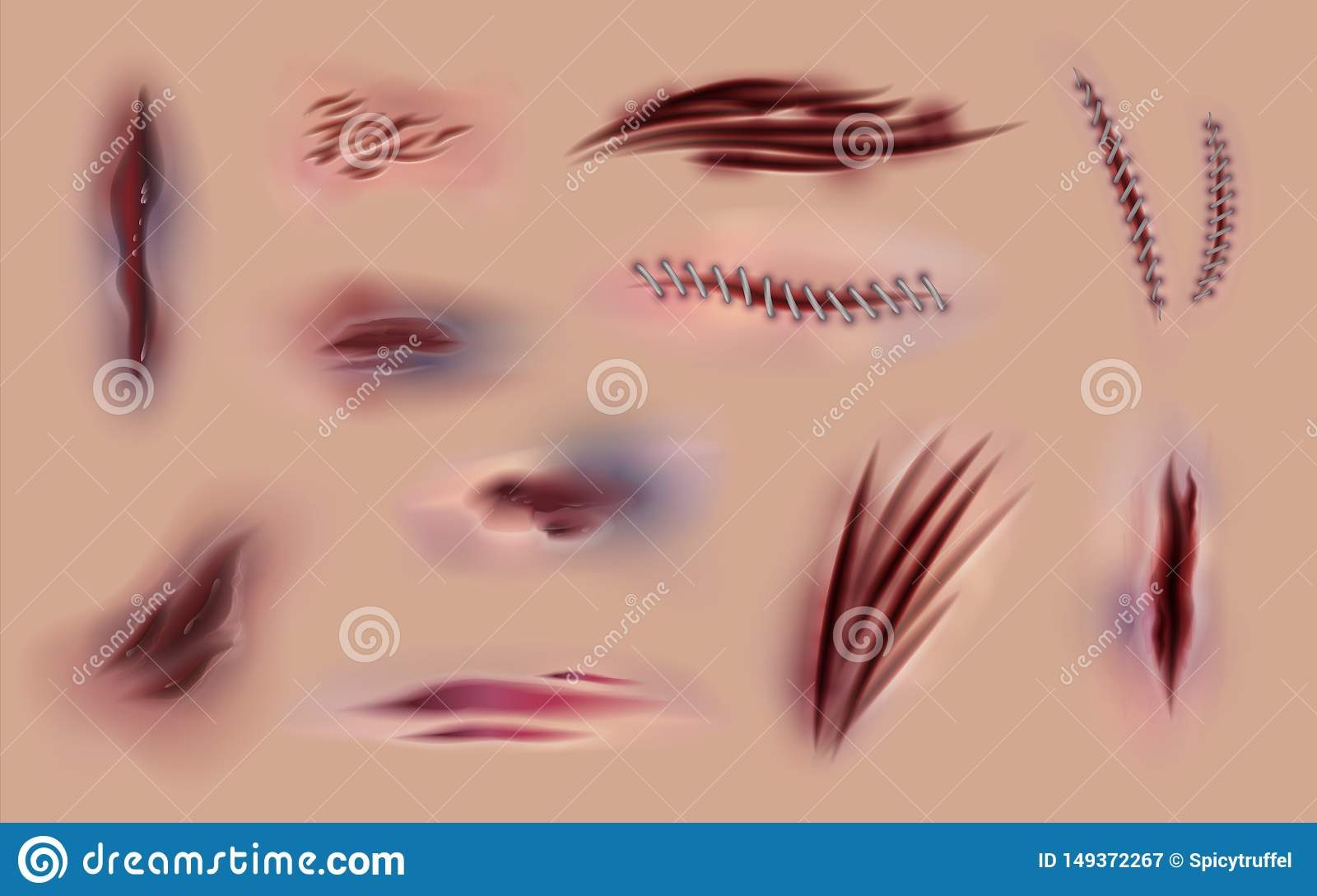 Detail Scar Wound Clipart Nomer 28