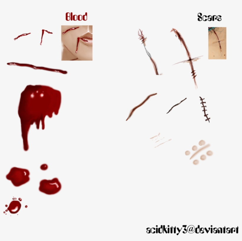 Detail Scars Download Nomer 5