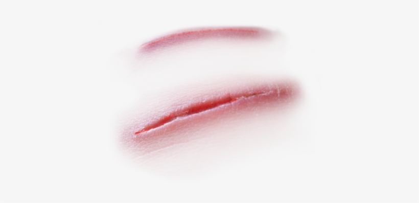 Detail Scars Download Nomer 6