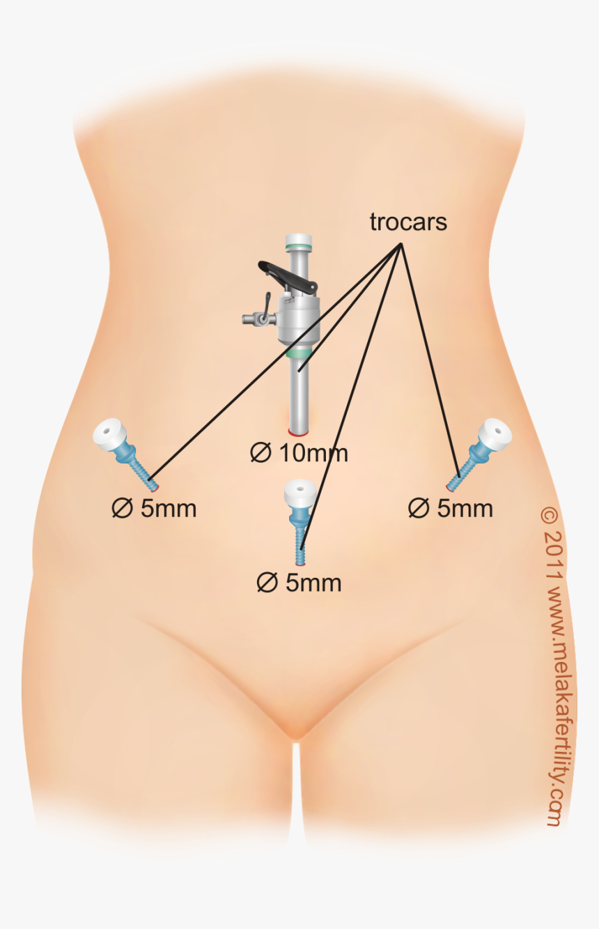 Detail Scars Download Nomer 50