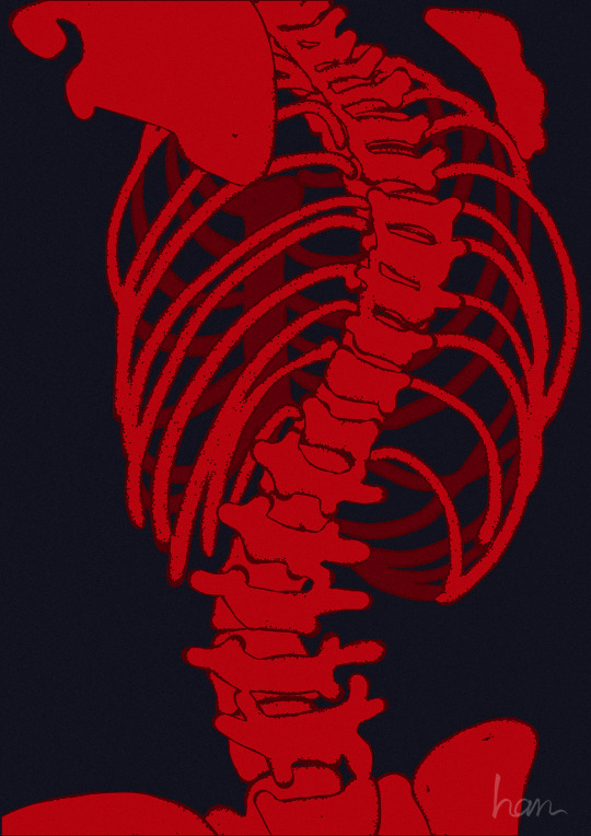 Detail Scoliosis Quotes Tumblr Nomer 37