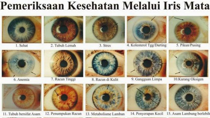 Detail Selaput Pelangi Pada Mata Nomer 22