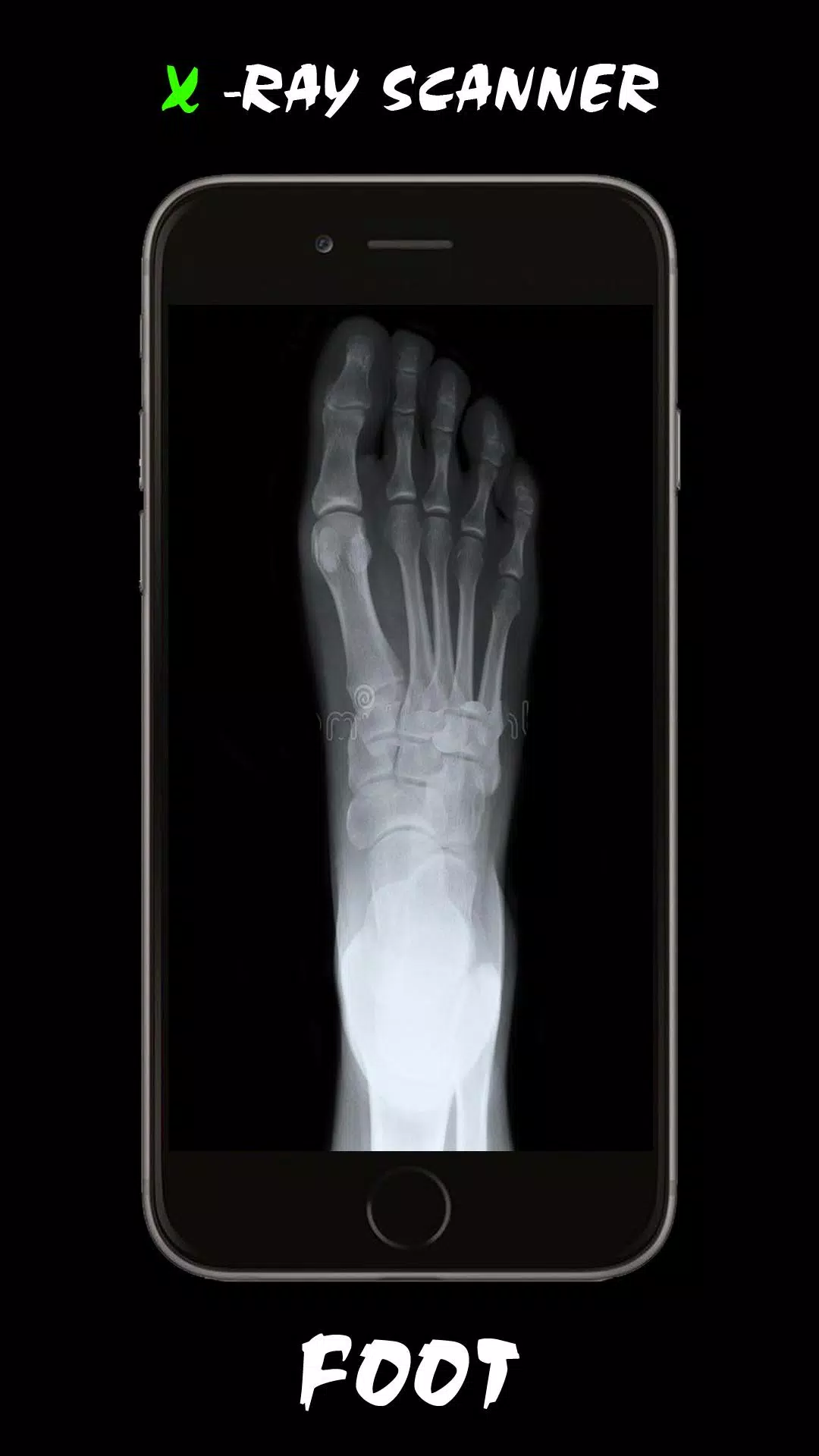 Detail Shark Xray Apk Nomer 8