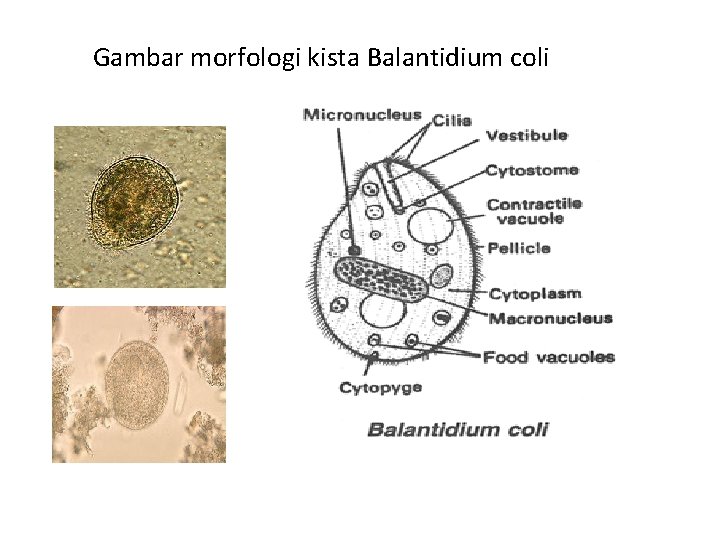 Detail Siklus Hidup Giardia Lamblia Nomer 29