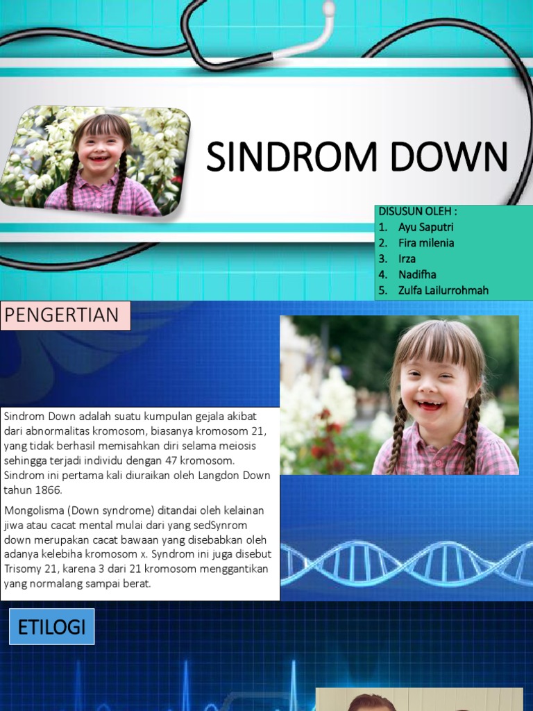 Detail Sindrom Down Merupakan Contoh Kelainan Yang Terjadi Akibat Nomer 32