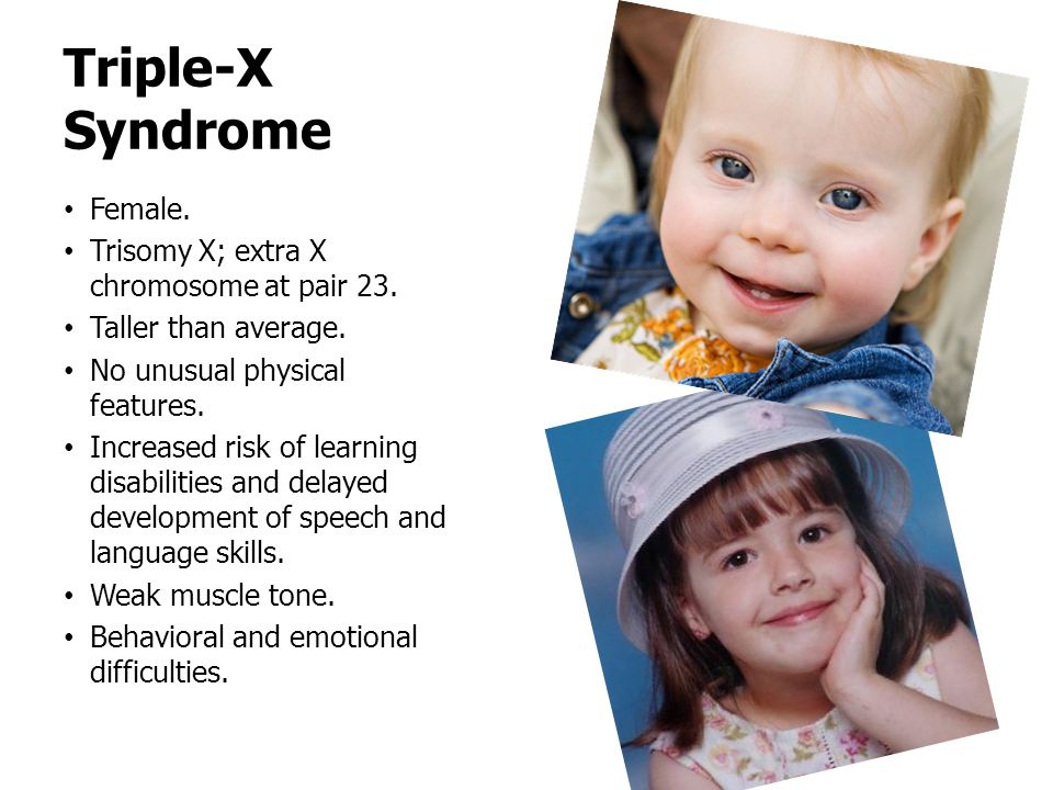 Detail Sindrom Triple X Nomer 17