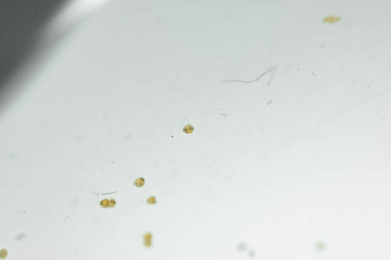 Detail What Do Comet Goldfish Eggs Look Like Nomer 30
