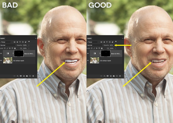 Detail Whitening Teeth In Photoshop Cc Nomer 52