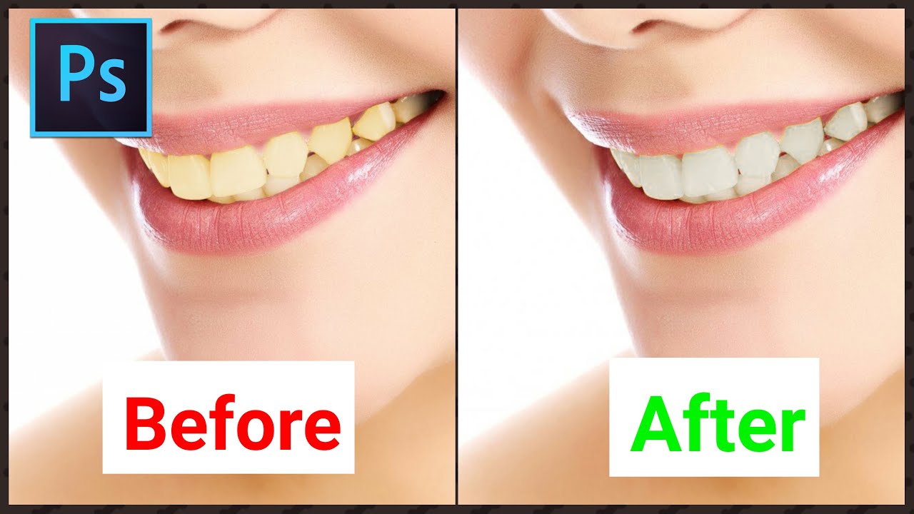 Detail Whitening Teeth In Photoshop Cc Nomer 7