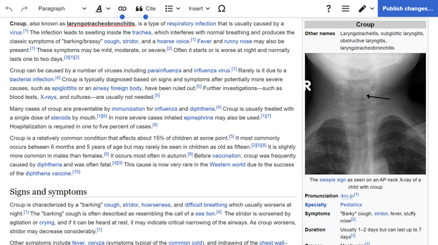 Detail Wikipedia Text Nomer 16