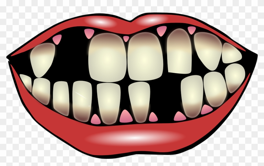 Detail Smile Teeth Png Nomer 40