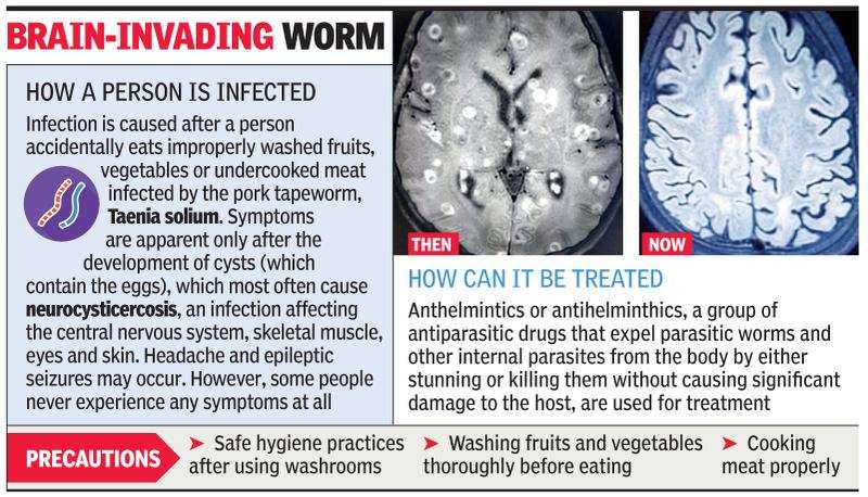 Detail Worms In Brain Due To Cabbage Nomer 18