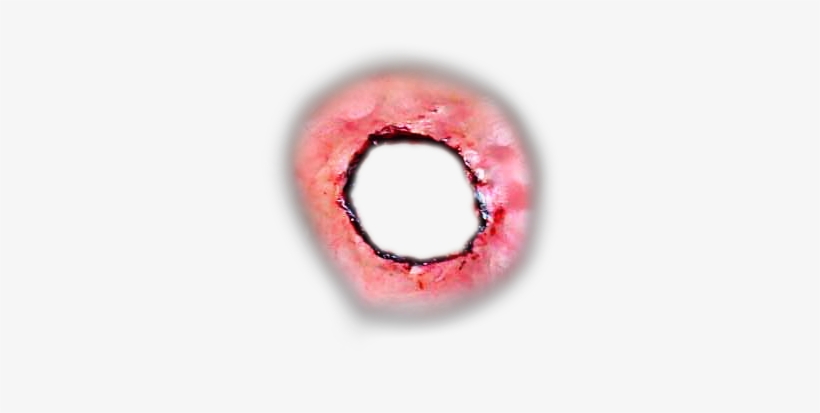 Detail Wound Bleeding Png Nomer 49