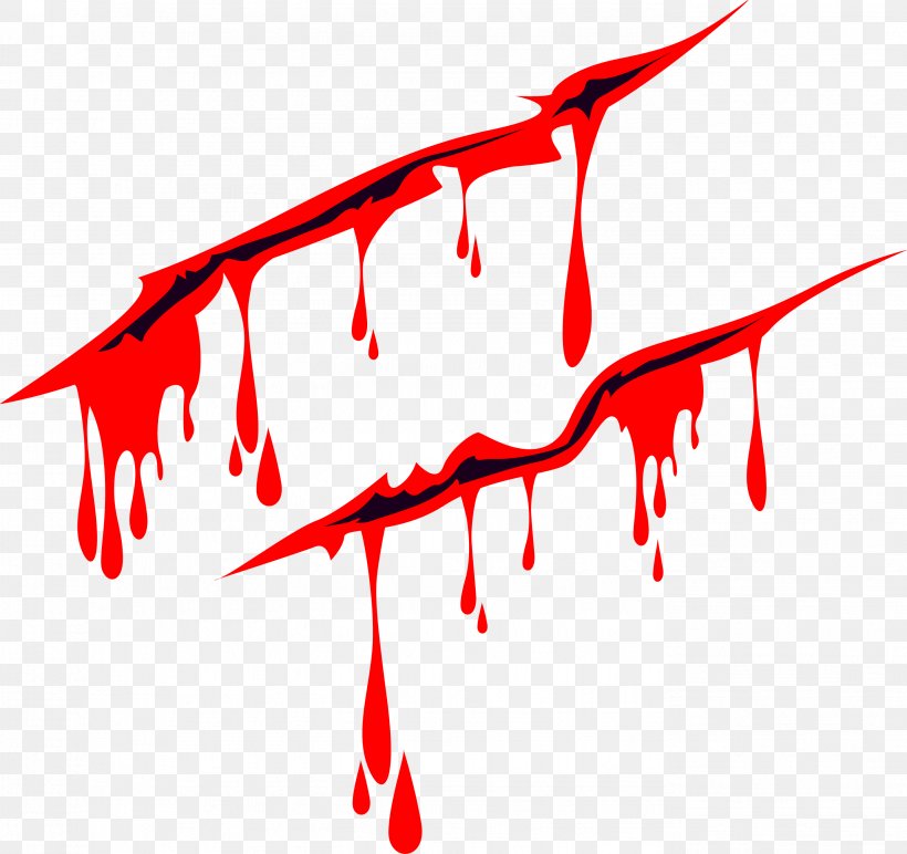 Detail Wound Bleeding Png Nomer 6