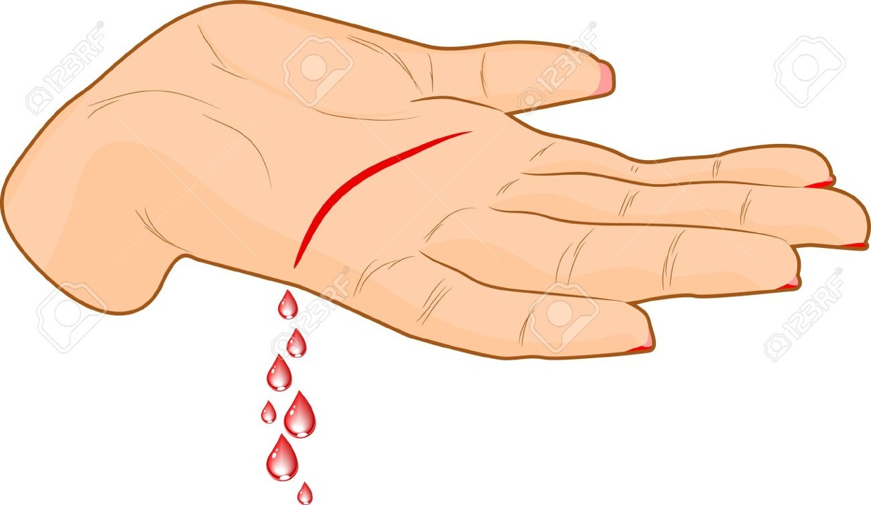 Detail Wounds Clipart Nomer 17