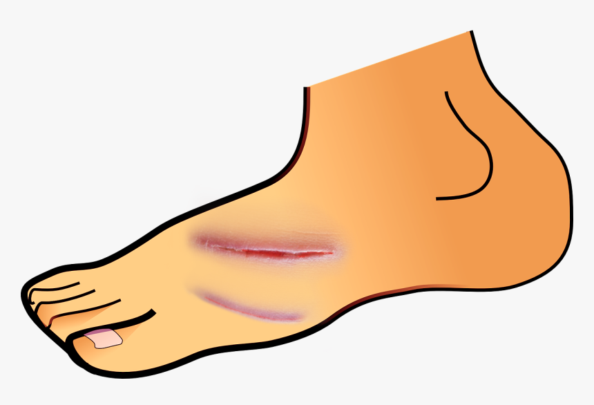 Detail Wounds Clipart Nomer 3