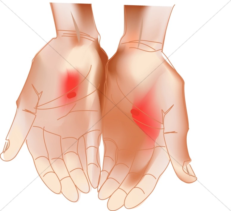 Detail Wounds Clipart Nomer 29