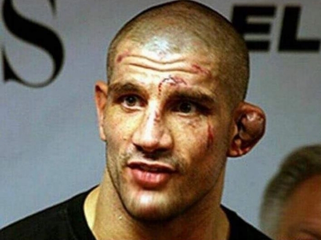 Detail Wrestling Cauliflower Ear Pictures Nomer 52