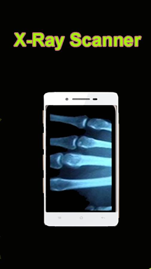 Detail X Ray Body Scanner Camera Apk Nomer 50