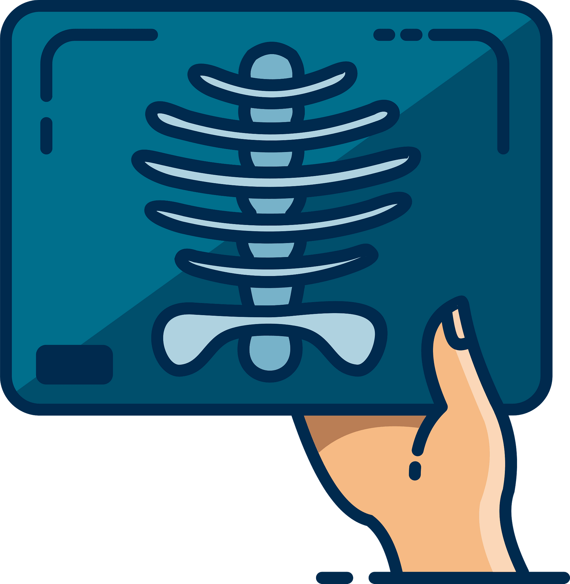 Detail X Ray Clipart Nomer 16