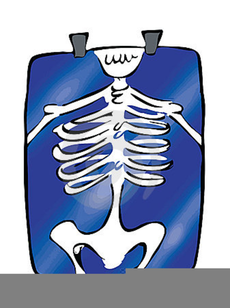 Detail X Ray Clipart Nomer 19