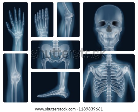 Detail X Ray Clipart Nomer 24