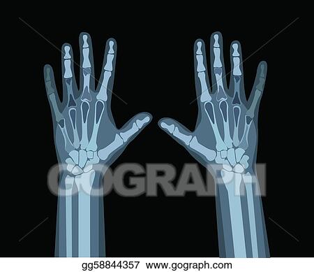 Detail X Ray Clipart Nomer 37