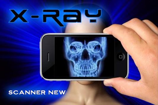 Detail X Ray Download Nomer 4