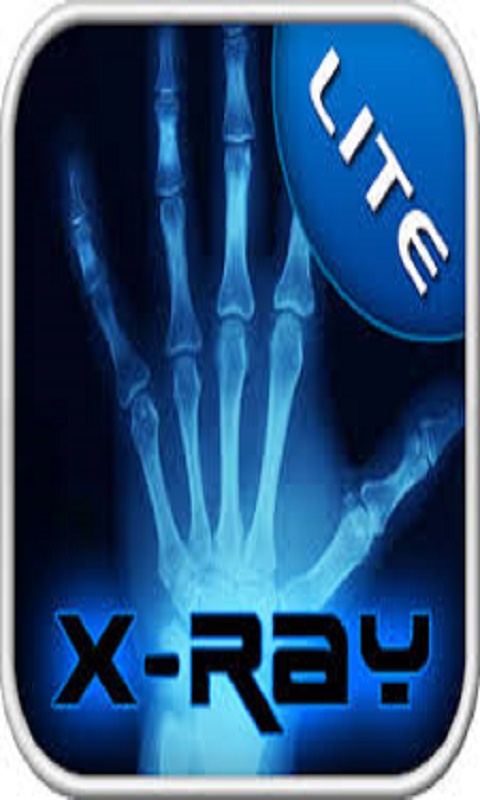 Detail X Ray Scanner Hd Apk Nomer 39