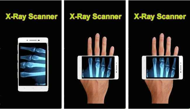 Detail X Ray Scanner Hd Apk Nomer 40