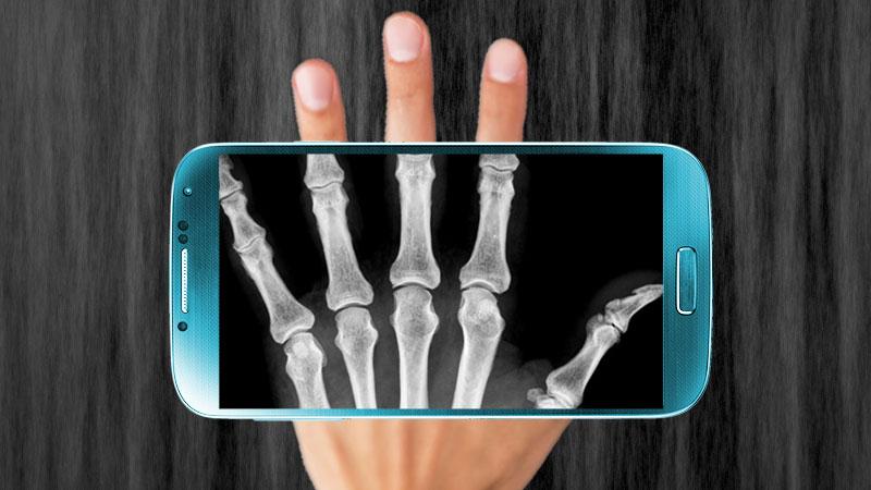 Detail X Ray Scanner Hd Apk Nomer 56