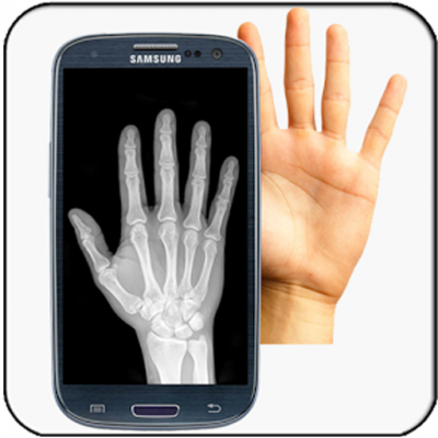 Detail X Ray Scanner Hd Apk Nomer 10