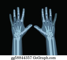 Detail X Rays Clipart Nomer 20