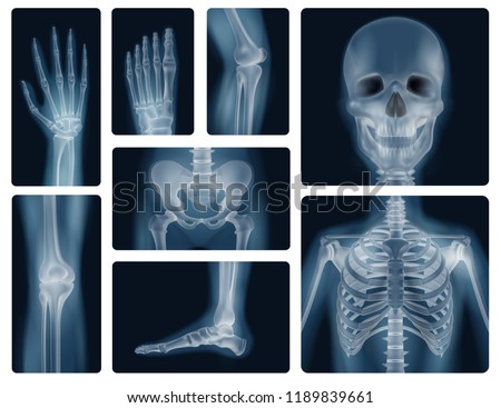 Detail X Rays Clipart Nomer 29