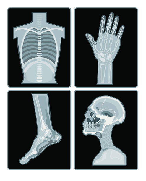 Detail X Rays Clipart Nomer 41