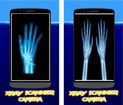 Detail Xray Scanner Camera Apk Nomer 19