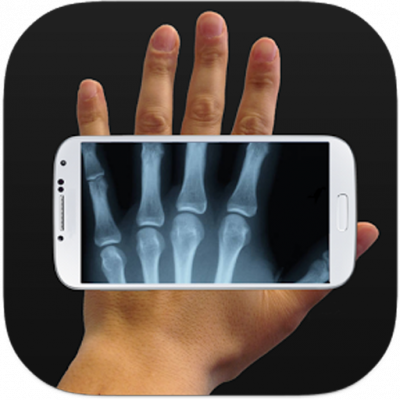 Detail Xray Scanner Camera Apk Nomer 24