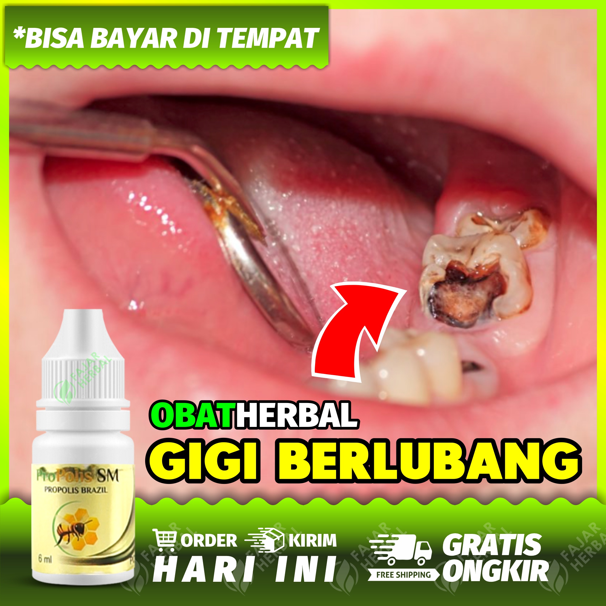 Detail Susu Beruang Untuk Sakit Gigi Nomer 50