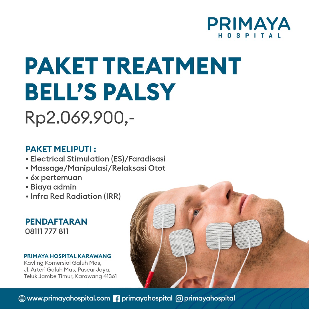 Detail Terapi Bells Palsy Di Rumah Nomer 32