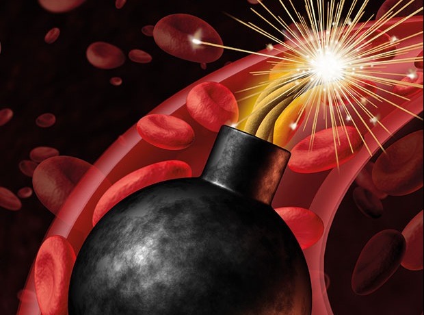 Detail Time Bomb Image Nomer 11