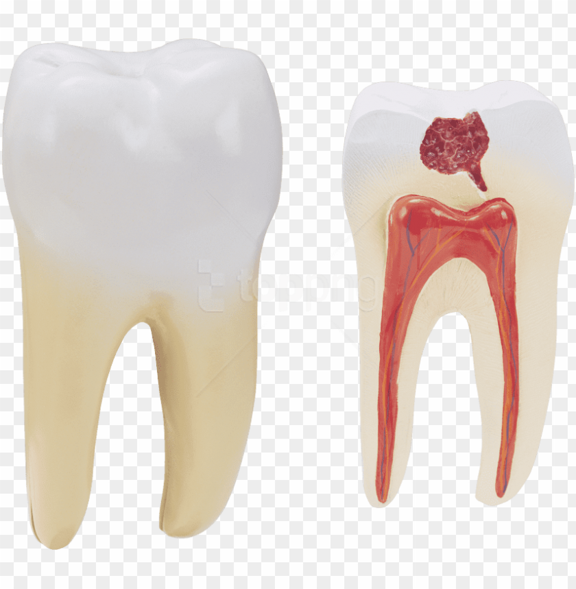 Detail Tooth Transparent Background Nomer 29