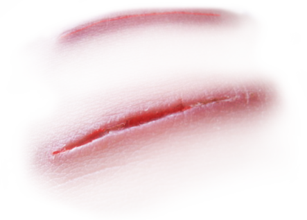 Detail Transparent Scars Nomer 12